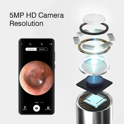 3.9mm HD Digital WiFi Ear Otoscope with AI Directional Function and WiFi Connectivity