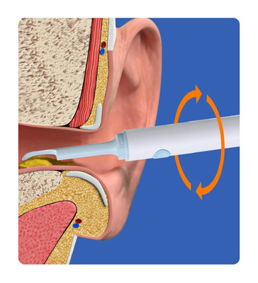 Smart Visual Ear Cleaning Rod Medical Camera Endoscope for Other Household Chemicals